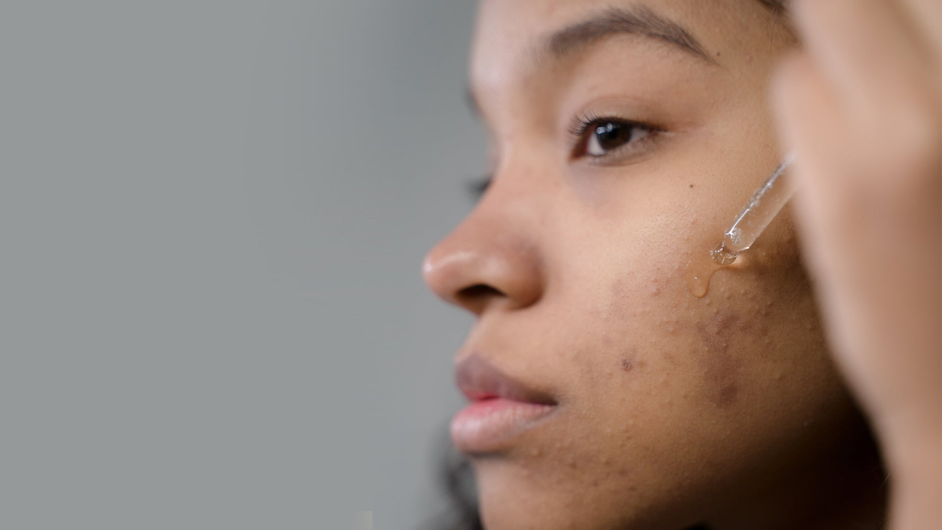 Face serum for causes acne 