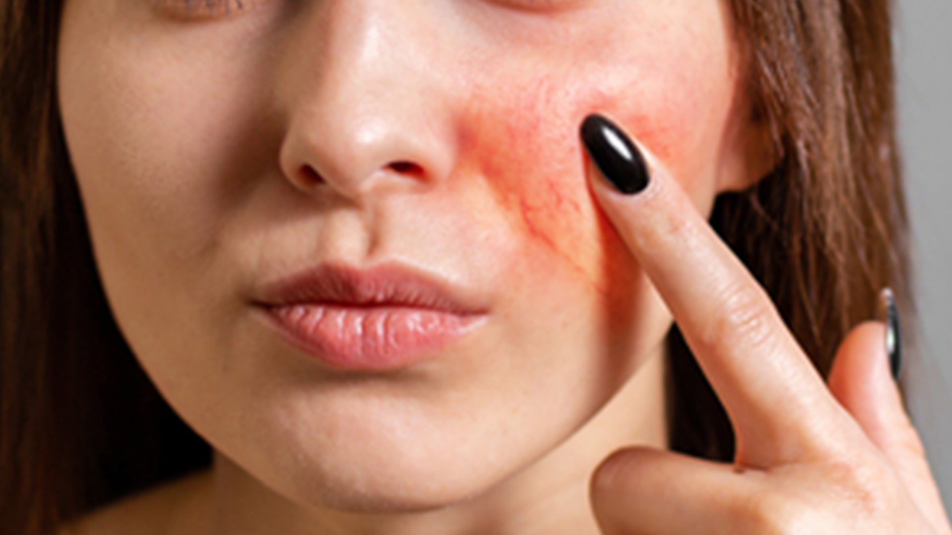 serum for sensitive skin