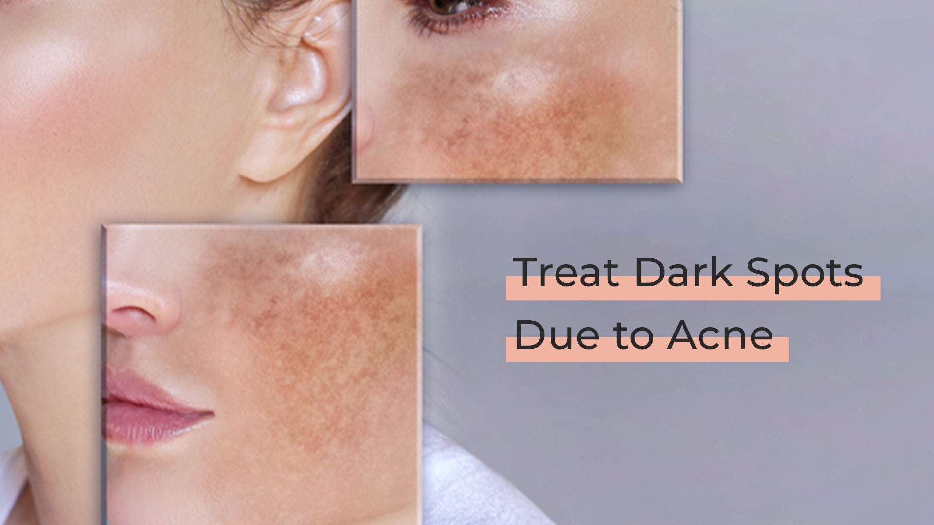 best facewash for oily and acne skin