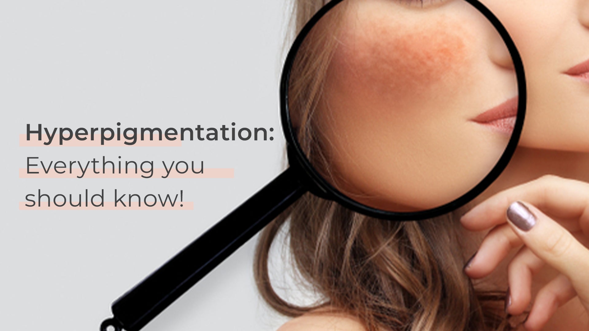 Hyperpigmentation: Everything you should know!