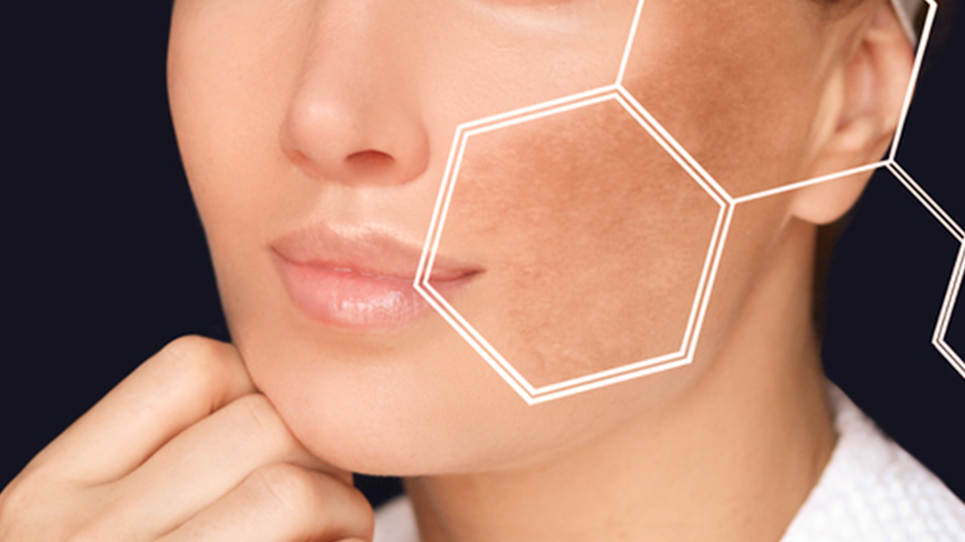 pigmentation on face