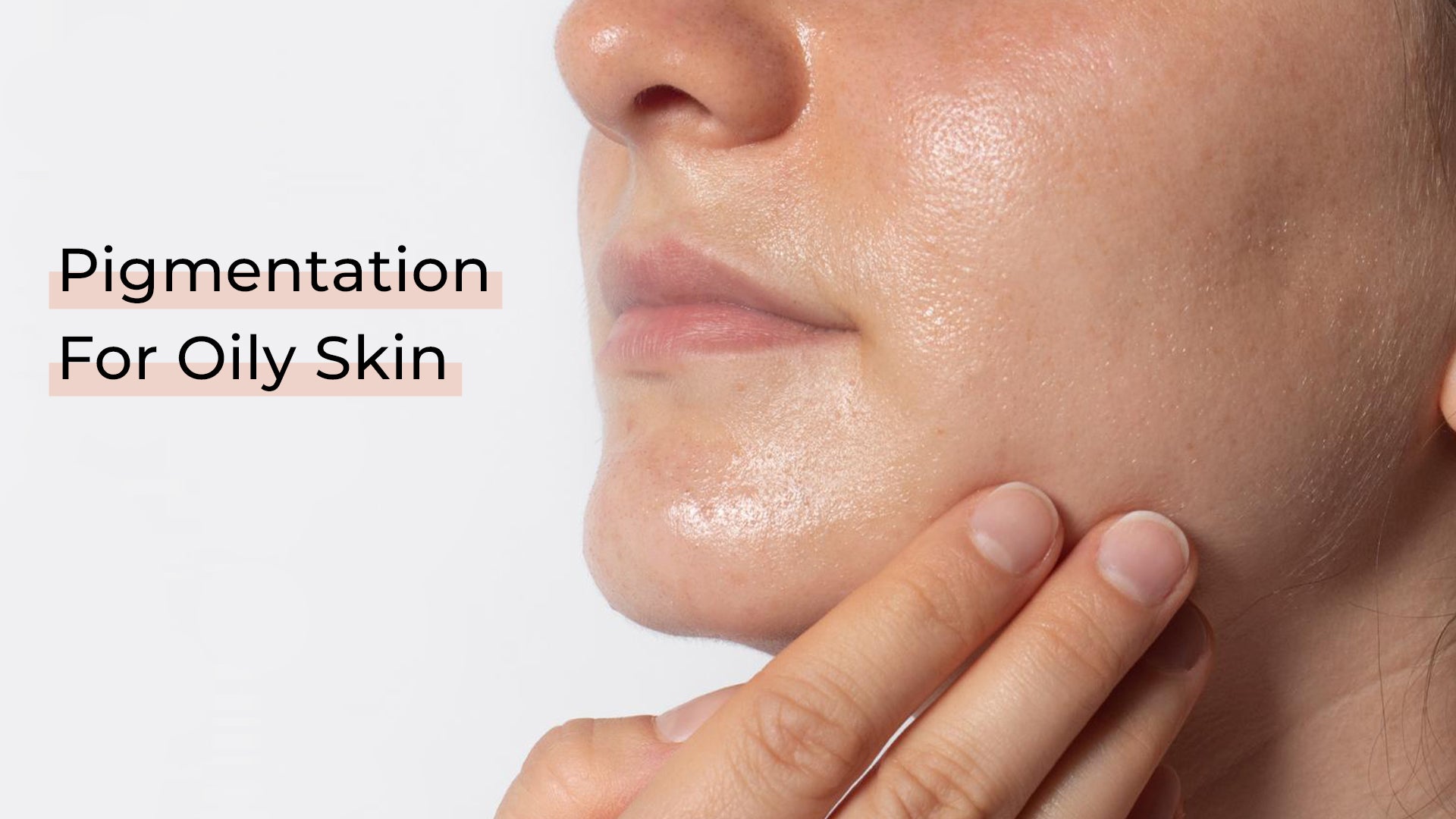 hyperpigmentation on face