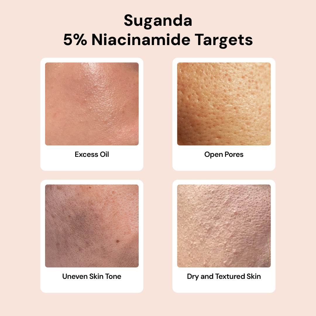 10% Niacinamide Serum