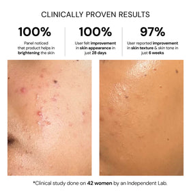 Advanced Pigmentation Serum