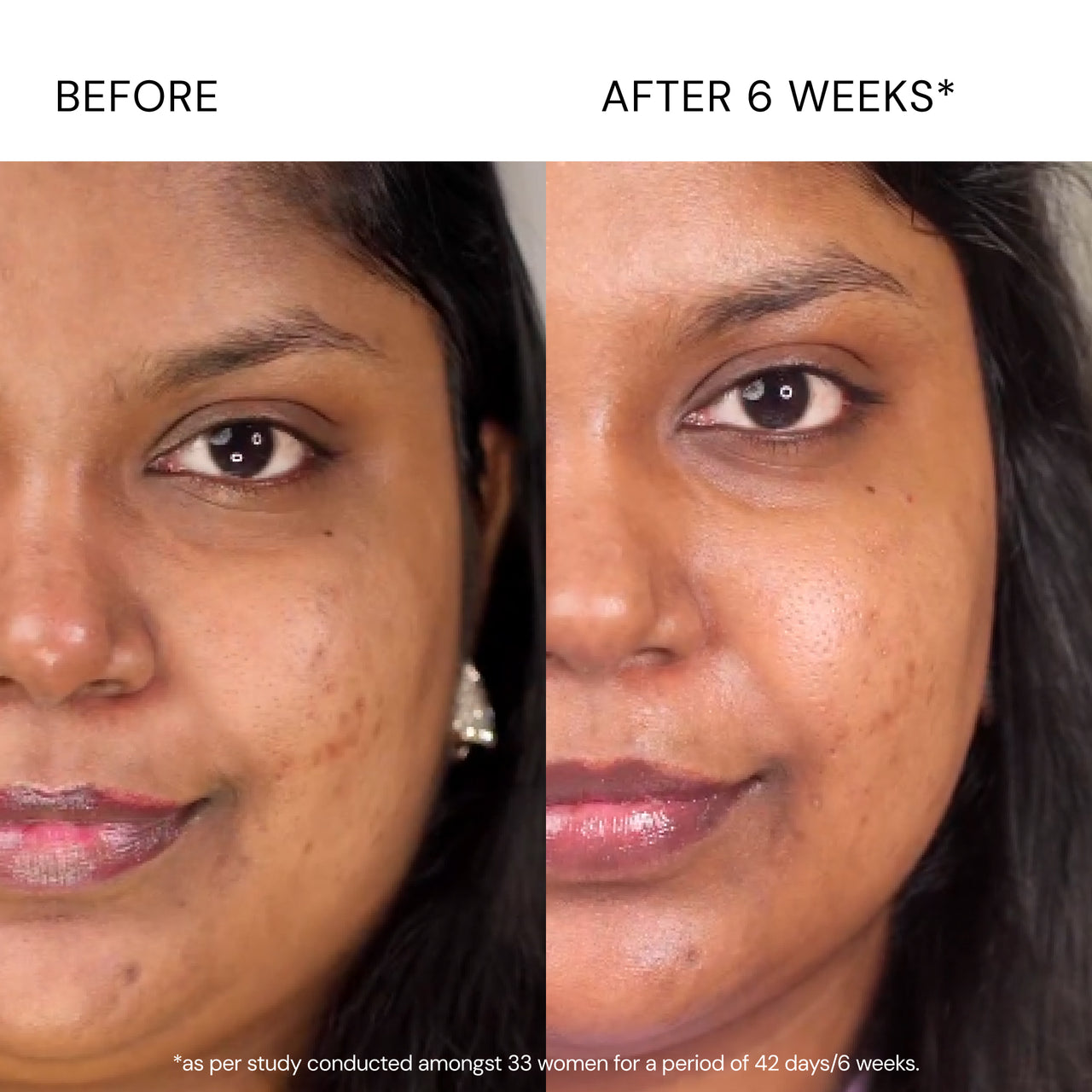 Advanced Pigmentation Serum
