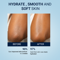 Thumbnail for Dry Therapy Lotion