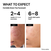 Thumbnail for Ultimate Brightening + Protect Kit