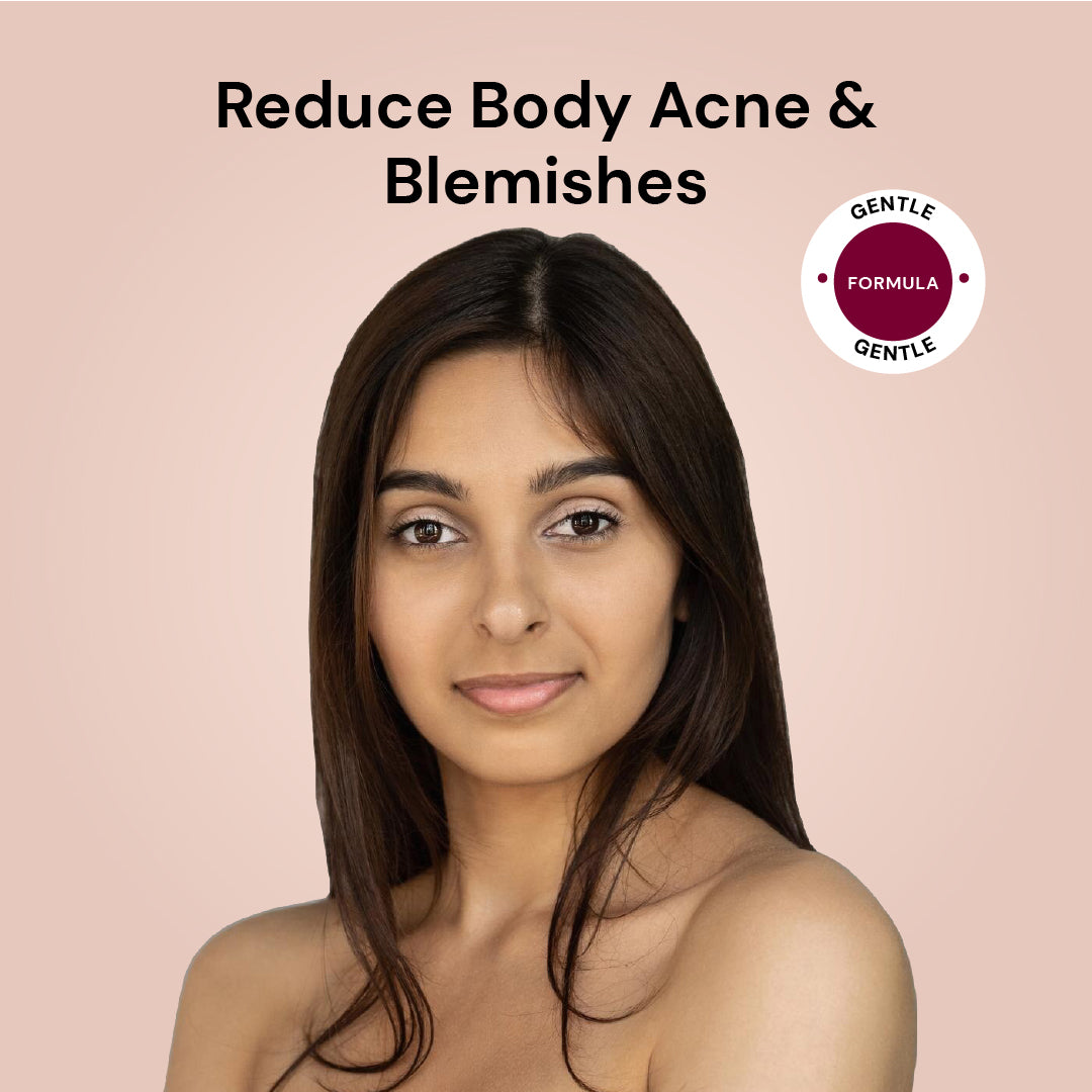Salicylic Acid 2% Acne Body Spray - Back and Body Acne Mist