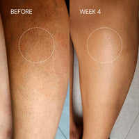Thumbnail for Lactic Body Lotion (500ml)