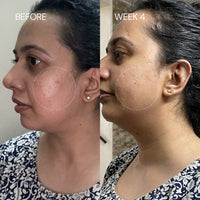 Thumbnail for 2% Granactive Retinoid
