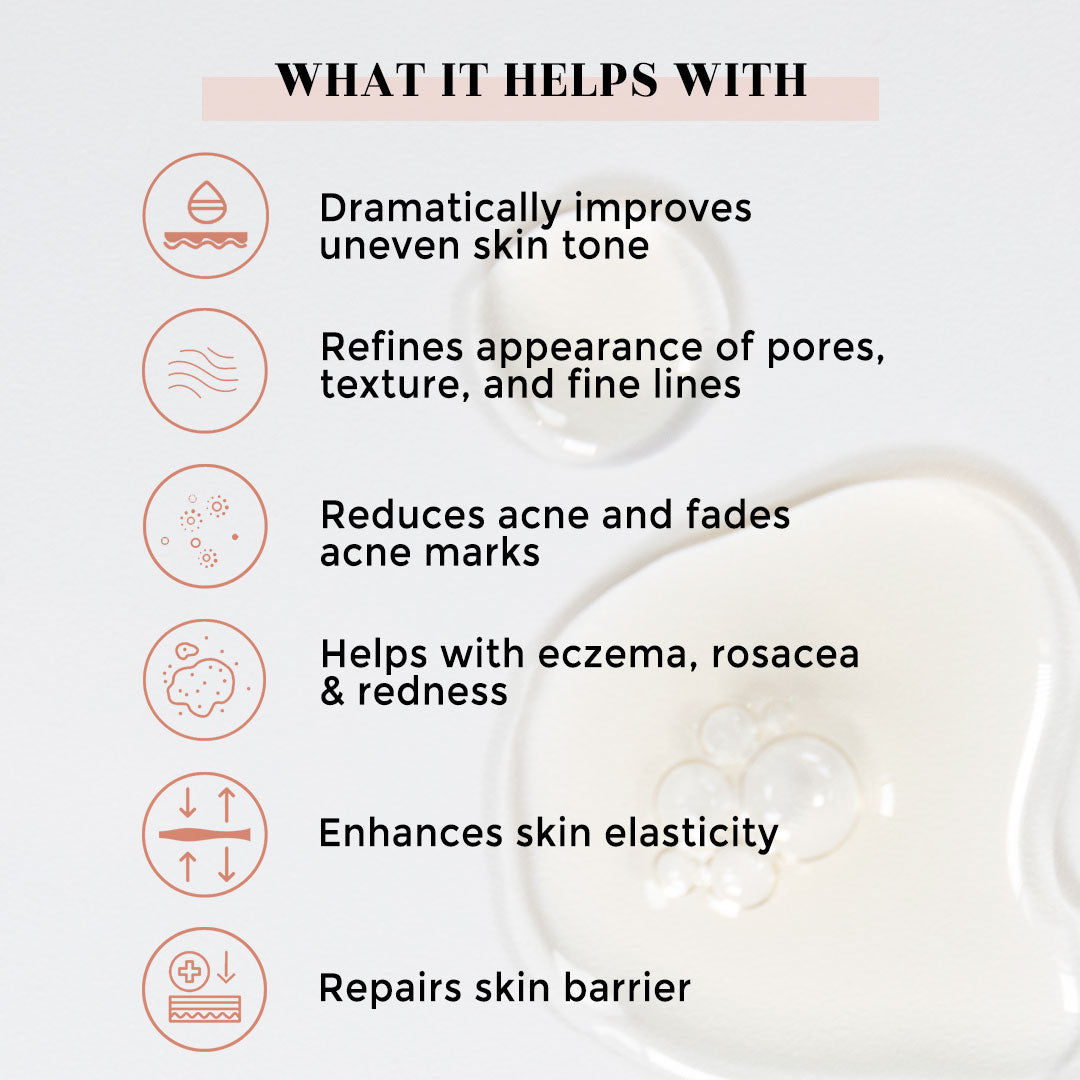 Face serum for acne