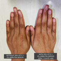 Thumbnail for 10% Vit C + 2% Arbutin Serum